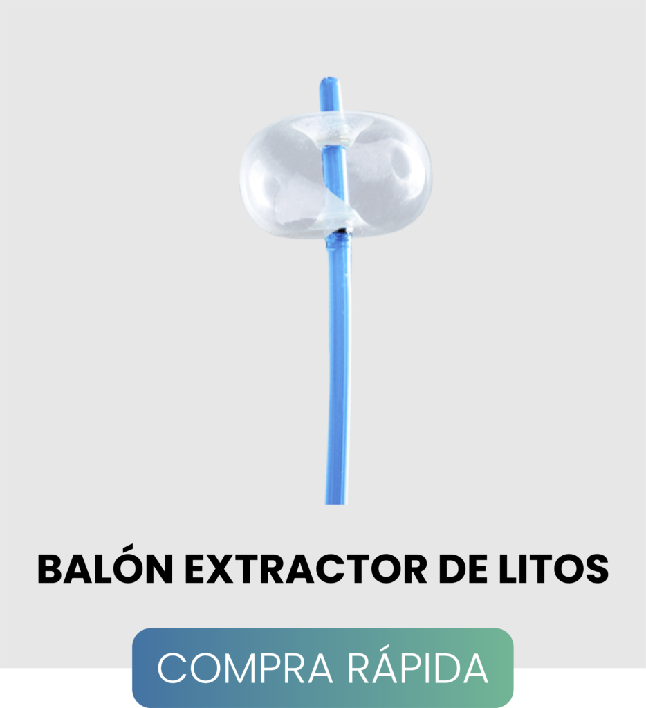 Dispositivo balón extractor para cálculos biliares con anillos de contraste y sistema de triple lumen