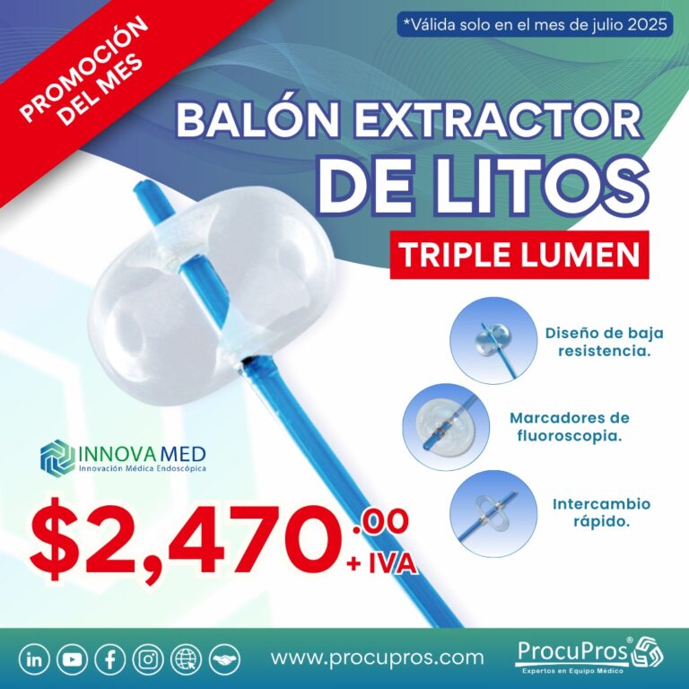 Balon extractor de litos