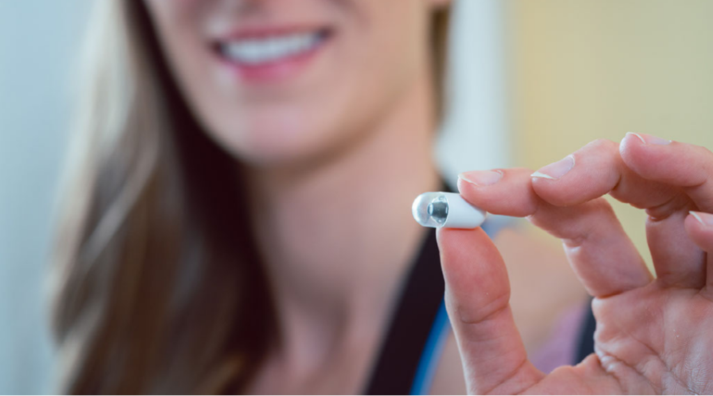 Capsula vs endoscopia