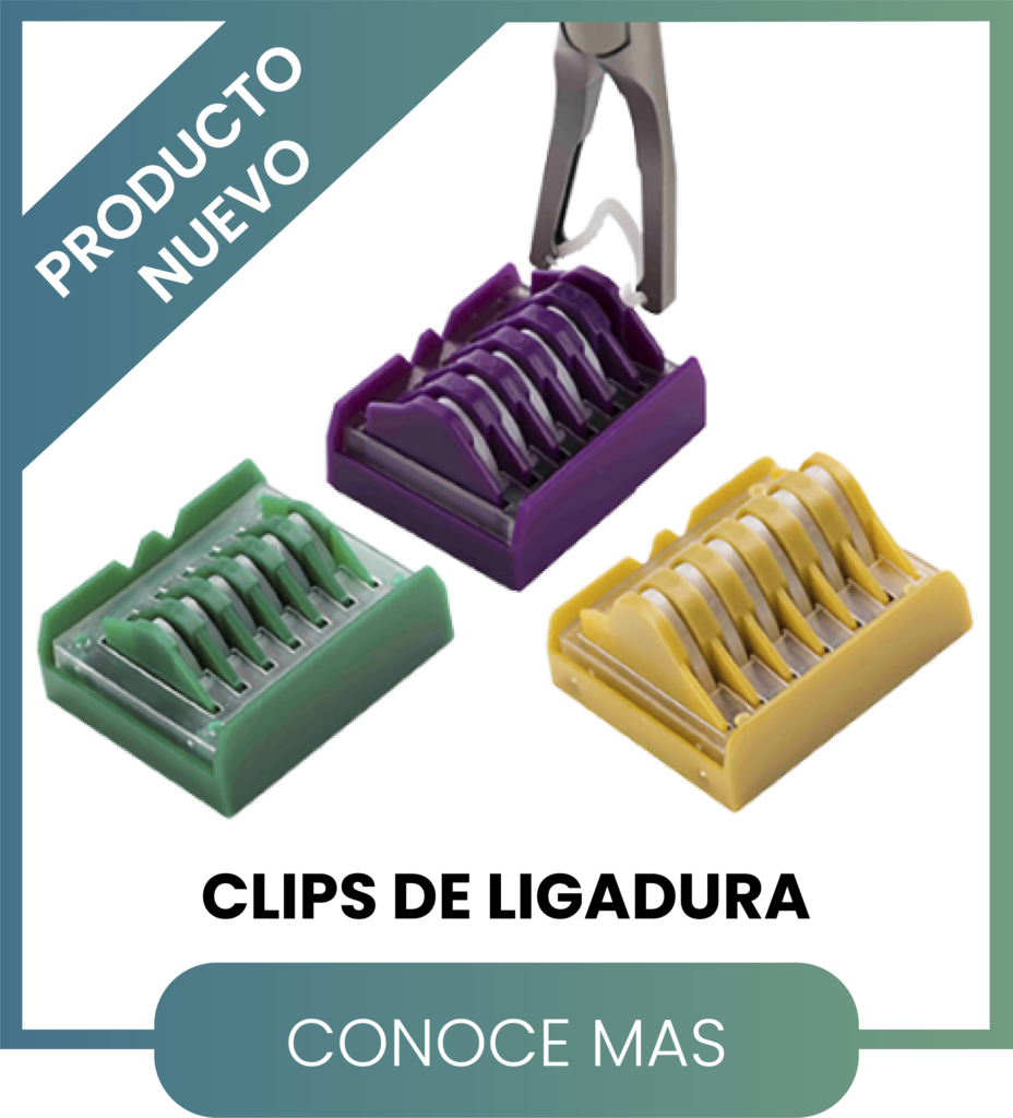 Clips de ligadura de diferentes tamaños